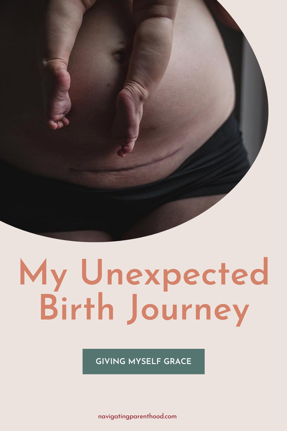 Giving Myself Grace: My Unexpected Birthing Journey